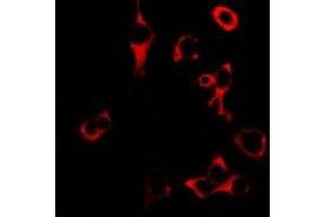 Immunofluorescent analysis of Granzyme B staining in U2OS cells.