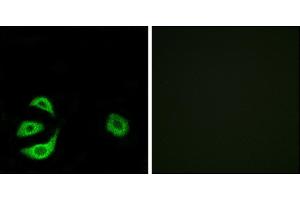 Immunofluorescence analysis of A549 cells, using ACOT8 antibody.