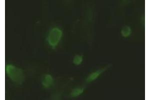 Anti-ID2 mouse monoclonal antibody (ABIN2452680) immunofluorescent staining of HeLa cells transiently transfected by pCMV6-ENTRYID2 (RC205324) (Id2 anticorps)