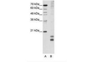 Image no. 1 for anti-Transcription Factor MafF (MAFF) (AA 33-82) antibody (ABIN203018) (MafF anticorps  (AA 33-82))