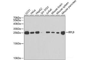 Western blot analysis of extracts of various cell lines using RPL9 Polyclonal Antibody at dilution of 1:1000. (RPL9 anticorps)