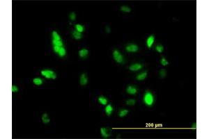 Immunofluorescence of monoclonal antibody to UBE2C on HeLa cell. (UBE2C anticorps  (AA 70-179))