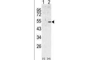 Western blot analysis of CCNA2 (arrow) using rabbit polyclonal CCNA2 Antibody (C-term) (ABIN391455 and ABIN2841432). (Cyclin A anticorps  (C-Term))