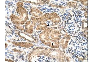 Immunohistochemistry (IHC) image for anti-GDP-Mannose Pyrophosphorylase B (GMPPB) (C-Term) antibody (ABIN2783544)