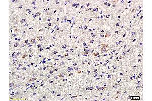 Formalin-fixed and paraffin embedded: rat brain tissue labeled with Anti-GAP-43 Polyclonal Antibody, Unconjugated (ABIN725555) at 1:200 followed by conjugation to the secondary antibody and DAB staining (GAP43 anticorps  (AA 9-100))