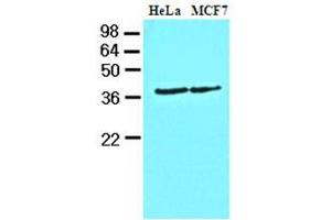 Western Blotting (WB) image for anti-Casein Kinase 1, alpha 1 (CSNK1A1) (AA 1-337), (N-Term) antibody (ABIN371879) (CSNK1A1 anticorps  (N-Term))