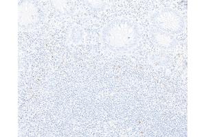 Immunohistochemistry (IHC) image for anti-Cytotoxic T-Lymphocyte-Associated Protein 4 (CTLA4) (C-Term) antibody (ABIN7795649)