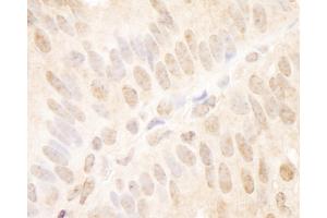 anti-Transcription Factor 12 (TCF12) (AA 1-50) antibody