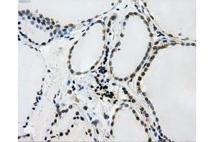 Immunohistochemical staining of paraffin-embedded Kidney tissue using anti-L1CAMmouse monoclonal antibody. (L1CAM anticorps)