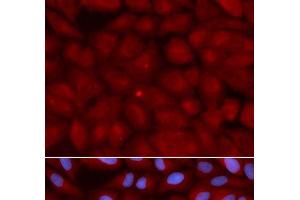 Immunofluorescence analysis of U2OS cells using BIN1 Polyclonal Antibody