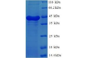 SDS-PAGE (SDS) image for Calpain, Small Subunit 1 (CAPNS1) (AA 1-268), (full length) protein (His-SUMO Tag) (ABIN5709195)