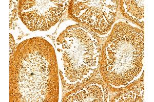 ABIN6263965 and ABIN6273063 at 1/100 staining Rat testis tissue by IHC-P.