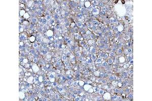 IHC analysis of CD276 using anti-CD276 antibody (ABIN7601136).