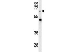 Western blot analysis of PRMT5 antibody and HL-60 lysate