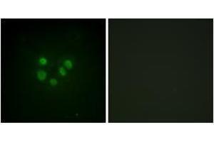 Immunofluorescence analysis of A549 cells, using Bloom Syndrome (Ab-99) Antibody. (Bloom Syndrome (AA 65-114) anticorps)