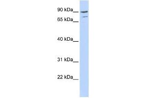 AKAP8 antibody used at 0. (AKAP8 anticorps  (Middle Region))