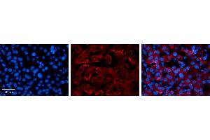 CTAGE5 antibody - middle region          Formalin Fixed Paraffin Embedded Tissue:  Human Liver Tissue    Observed Staining:  Membrane in hepatocytes   Primary Antibody Concentration:  1:100    Secondary Antibody:  Donkey anti-Rabbit-Cy3    Secondary Antibody Concentration:  1:200    Magnification:  20X    Exposure Time:  0.