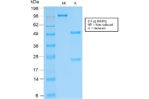 SDS-PAGE Analysis Purified SOX9 Recombinant Rabbit Monoclonal Antibody (SOX9/2287R). (Recombinant SOX9 anticorps)