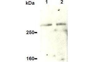 Western Blotting (WB) image for anti-Ataxia Telangiectasia and Rad3 Related (ATR) antibody (ABIN1449281) (ATR anticorps)