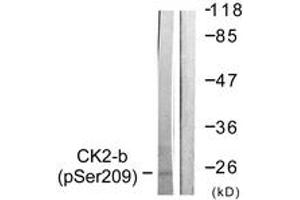 Western blot analysis of extracts from HuvEc cells, using CKII-beta (Phospho-Ser209) Antibody. (CSNK2B anticorps  (pSer209))