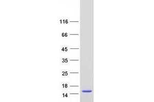 Validation with Western Blot