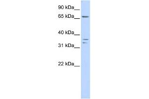 WB Suggested Anti-IQCE Antibody Titration: 0. (IQCE anticorps  (Middle Region))