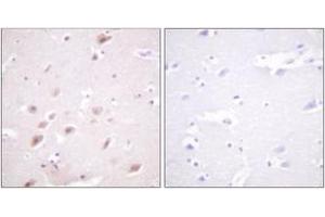 Immunohistochemistry analysis of paraffin-embedded human brain, using CKII-beta (Phospho-Ser209) Antibody.