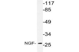 Western blot analysis of NGF Antibody in extracts from Jurkat cells. (Nerve Growth Factor anticorps)