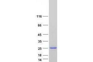 Validation with Western Blot