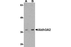 Western Blotting (WB) image for anti-Aldehyde Dehydrogenase 3 Family, Member A2 (ALDH3A2) (C-Term) antibody (ABIN1030231) (ALDH3A2 anticorps  (C-Term))