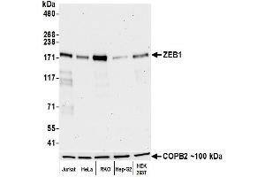 Western Blotting (WB) image for anti-Zinc Finger E-Box Binding Homeobox 1 (ZEB1) (AA 750-800) antibody (ABIN7455173) (Recombinant ZEB1 anticorps  (AA 750-800))