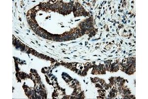 Immunohistochemical staining of paraffin-embedded Kidney tissue using anti-PTPRE mouse monoclonal antibody. (PTPRE anticorps)