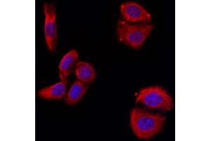 ABIN6263291 and ABIN6266590 staining Hela by IF/ICC. (MMP11 anticorps  (N-Term))