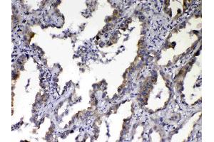 IHC analysis of NOV/CCN3 using anti-NOV/CCN3 antibody . (NOV anticorps  (C-Term))