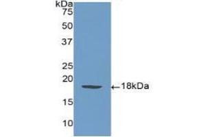 Detection of Recombinant SELP, Human using Polyclonal Antibody to P-Selectin (SELP)