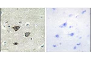 Immunohistochemistry analysis of paraffin-embedded human brain tissue, using CDH8 Antibody. (Cadherin 8 anticorps  (AA 491-540))