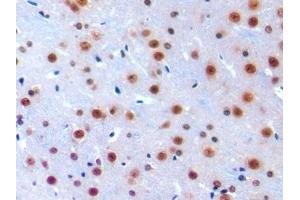 Detection of IRF1 in Mouse Cerebrum Tissue using Polyclonal Antibody to Interferon Regulatory Factor 1 (IRF1)