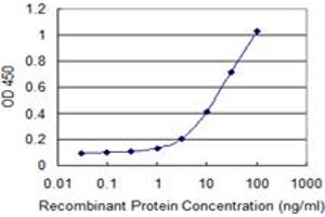 Detection limit for recombinant GST tagged RNF113A is 0.
