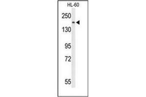 Western blot analysis of PLCB1 Antibody (C-term) in HL-60 cell line lysates (35ug/lane). (Phospholipase C beta 1 anticorps  (C-Term))
