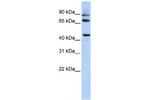 DPP10 antibody used at 1 ug/ml to detect target protein. (DPP10 anticorps  (Middle Region))