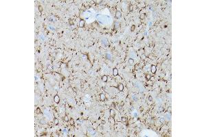 Immunohistochemistry of paraffin-embedded mouse brain using α-Tubulin Mouse mAb (ABIN7271035) at dilution of 1:100 (40x lens). (TUBA4A anticorps)