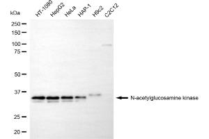 Western blotting analysis using N-acetylglucosamine kinase antibody (ABIN7799530). (NAGK anticorps)