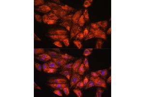Immunofluorescence analysis of H9C2 cells using PPP1R15A Rabbit pAb (ABIN7269676) at dilution of 1:100.