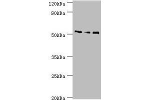 Western blot All lanes: Neuronal acetylcholine receptor subunit alpha-5 antibody at 12 μg/mL Lane 1: Jurkat whole cell lysate Lane 2: A431 whole cell lysate Lane 3: A549 whole cell lysate Secondary Goat polyclonal to rabbit IgG at 1/10000 dilution Predicted band size: 53 kDa Observed band size: 53 kDa (CHRNA5 anticorps  (AA 23-240))