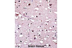 Immunohistochemistry (IHC) image for anti-Parkinson Protein 2, E3 Ubiquitin Protein Ligase (Parkin) (PARK2) antibody (ABIN3002635)