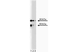 Western blot anakysis of Chk2 on RSV-3T3 lysate. (CHEK2 anticorps  (AA 31-234))