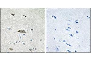 Immunohistochemistry analysis of paraffin-embedded human brain, using RPL39L Antibody. (RPL39L anticorps  (AA 1-50))