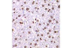 Immunohistochemistry of paraffin-embedded mouse liver using SSRP1 antibody at dilution of 1:200 (400x lens). (SSRP1 anticorps)