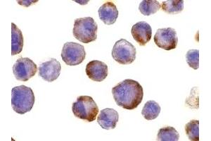 Immunohistochemistry (IHC) image for anti-ADAM Metallopeptidase Domain 17 (ADAM17) (C-Term) antibody (ABIN1030720)