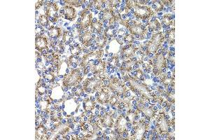 Immunohistochemistry of paraffin-embedded rat kidney using COPS2 antibody (ABIN6130123, ABIN6138877, ABIN6138878 and ABIN6222819) at dilution of 1:100 (40x lens).